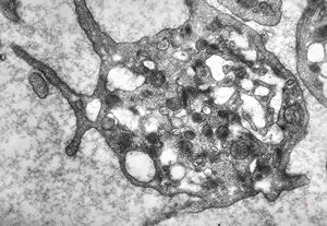 thrombocyte thrombocyte